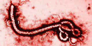 Ebola, o monstro dos dias atuais. Descoberto a 40 anos e só agora levado a sério.